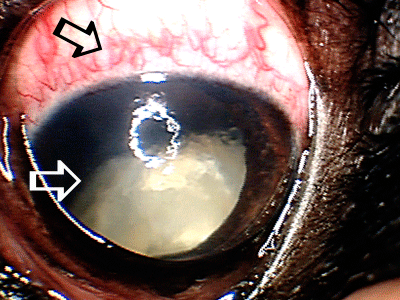 long standing cataract