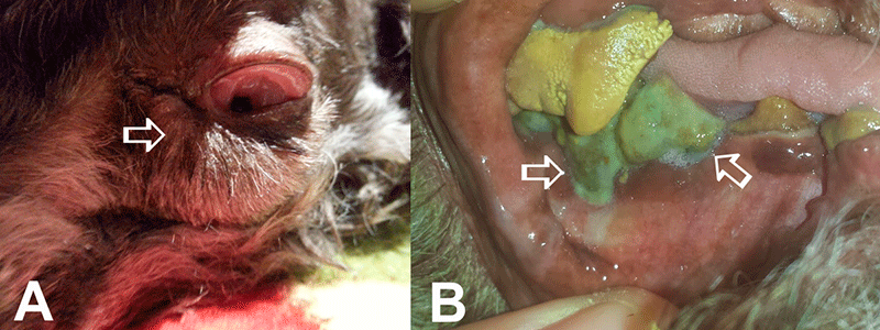 postoperative swelling of ocular and periocular structures